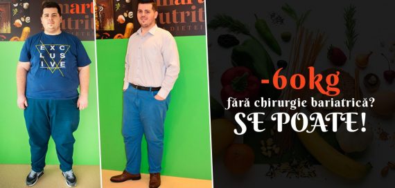 inainte-dupa-pop-up-site-e1580298876985 slăbit fără chirurgie bariatrică