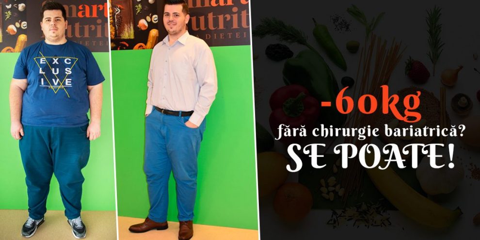 slăbit fără chirurgie bariatrică
